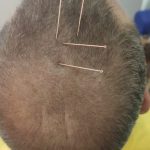 Curso craneopuntura china estilo jiao madrid