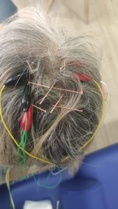 Curso craneopuntura china estilo jiao madrid